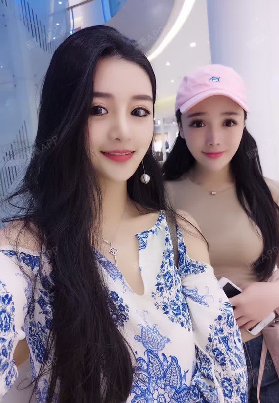 新氧 - Jelly_492375 | 微整形 | 术后当自强 | 国内整形 新氧 - Jelly_492375 | 微整形 | 术后当自强 | 国内整形