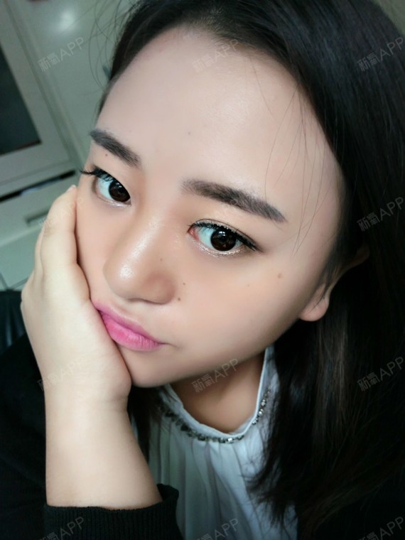 疤掉完了.开始反色啦!可以美美的出门咯