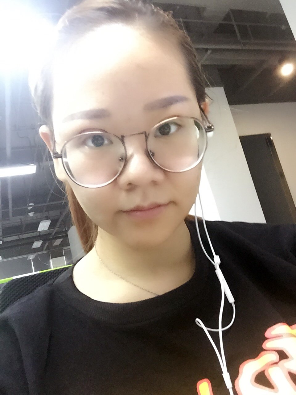 开内眼角怎么样_恢复过程_效果如何_氧气_gym1db75c9.