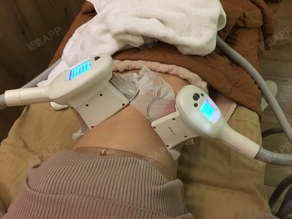 成都冷冻溶脂瘦腹部好不好_效果图_joy_babe冷冻溶脂1