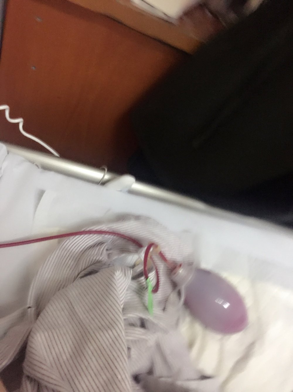 假体隆胸第2天