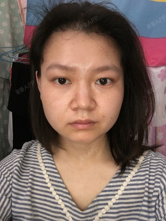 从小大饼脸,年轻不大,看起来却老气横秋,_圈子-新氧