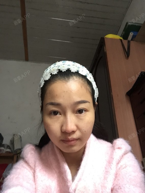 新氧-漪_858857|瘦脸毒素|肉面部瘦腿|微整形|肉轮廓|术后妮植芙毒素精图片