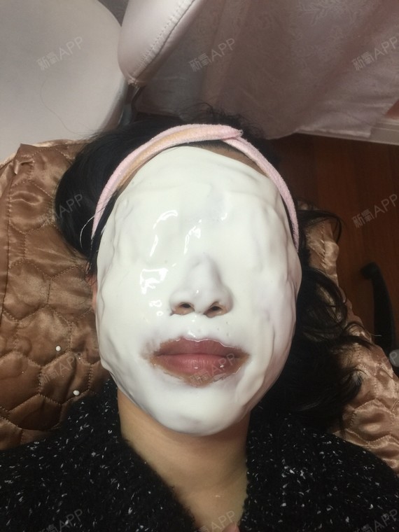 酸甜小天使玻尿酸导入第0天美丽日记-新氧美容