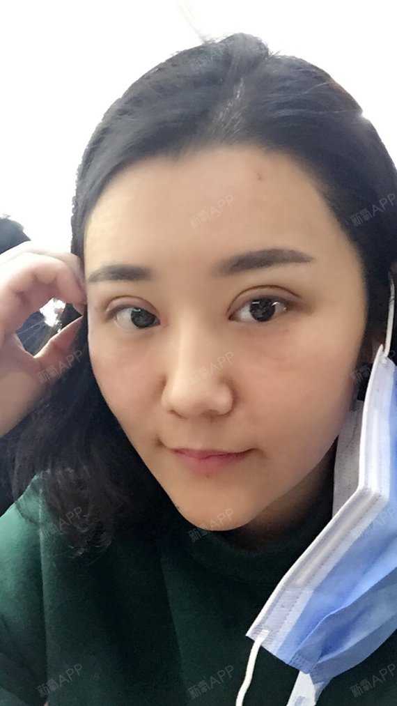 ... 备 孕 的 话 打 瘦脸 针 的 计划 就 先 搁置 一下 吧