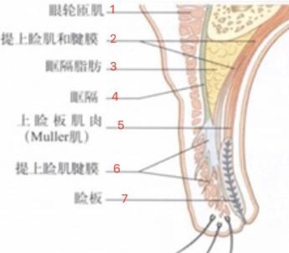 菡式op双眼皮?最新韩国技术你get到了