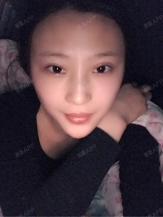 加上这次市第三次哒瘦脸 以前不知道有新氧这个app 真的便宜了