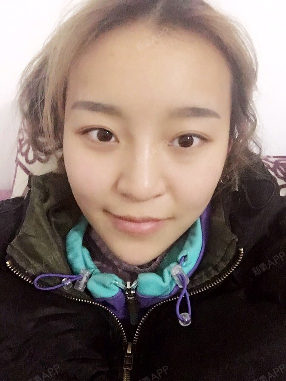 打了6个月?下巴突然肿了第一次吃消炎药下去