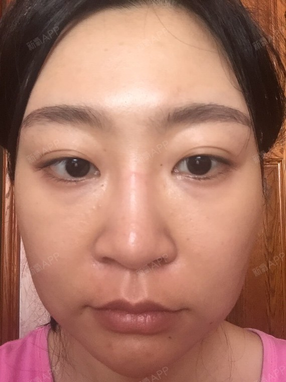 由于v瘦脸,瘦脸针,溶脂针的缘故,虽然这一年脸瘦了不少瘦身霜恒爽图片