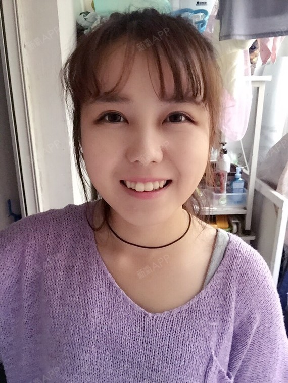 尤其是两颗大门牙,比旁边的牙大好多,很像兔牙,而且有点歪,还有点往前