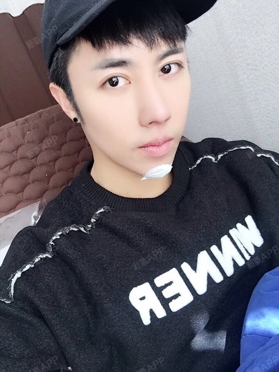 刘泽雨玻尿酸垫下巴第4天美丽日记-新氧美容整