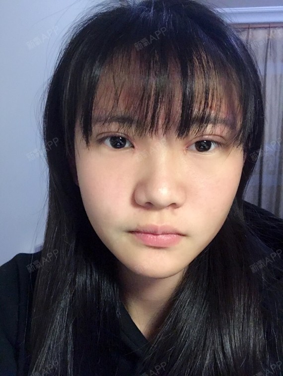 希望知道侧脸应该怎么办才能立体一些