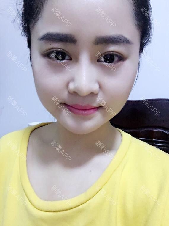 顶着一张大饼脸是什么样的体验?明明很瘦,也会显得很