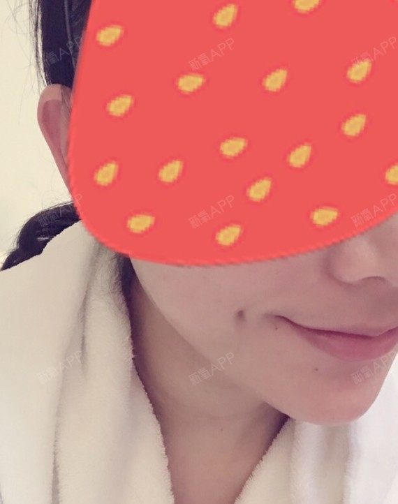 通过新氧消费方案查看开内眼角手术中度疼痛眼形美化机构查看重庆