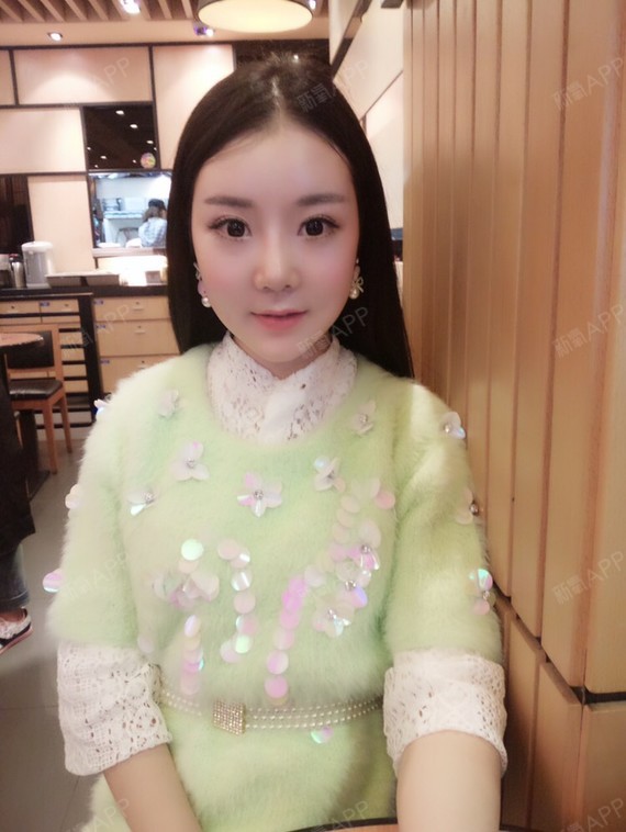 面部溶脂后期恢复要3个月吗?永久的吗?会不会