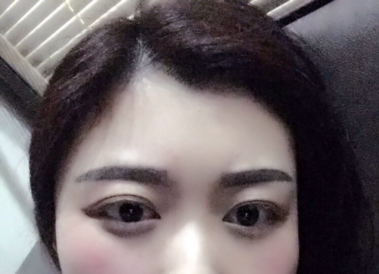结痂脱落期半永久纹眉第 天           ·           第5篇日记