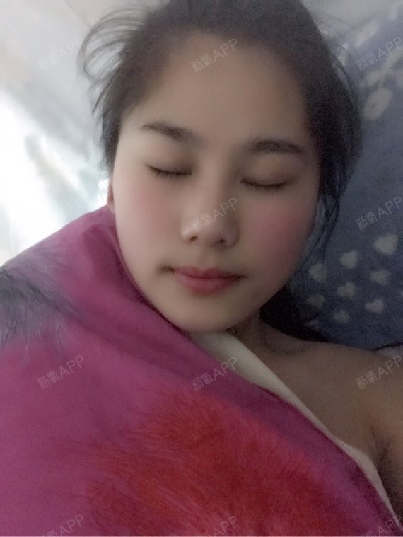 脸上打了白毒,小腿也打了肉毒素,大腿和肚子打了溶脂针,感觉都没 白