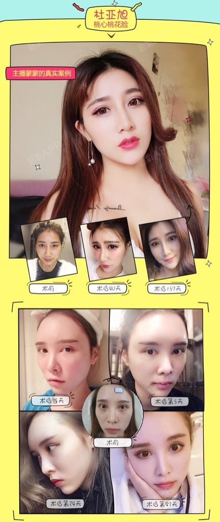 重庆铂生整形&新氧app