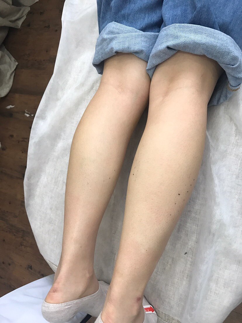 一般女生不会小腿肌肉这么发达