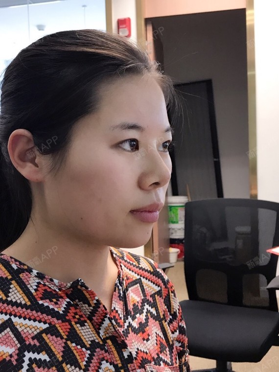 新氧昵称:小鳄鱼吃西瓜