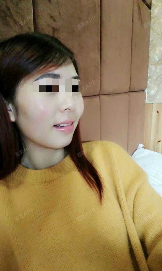 原来每个人都要经历马脸和婆婆嘴的过程,_圈子-新氧美容整形