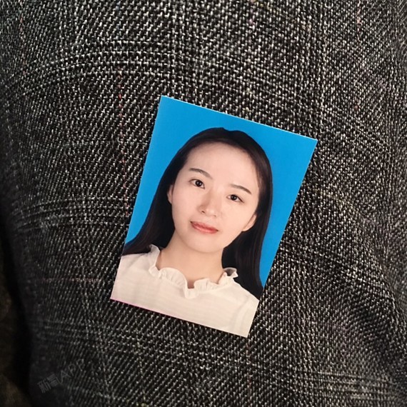 由于我在老家这边一个亲戚的美容院做的双眼皮