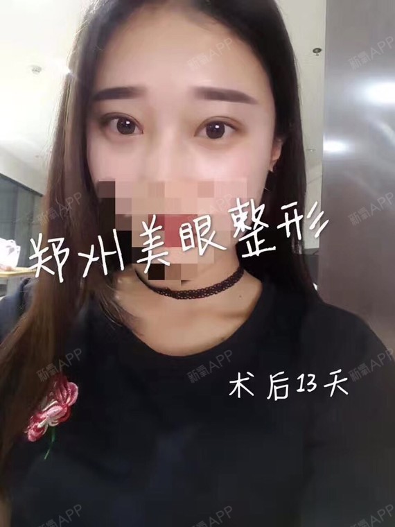 片整形郑州美眼来自裤子手术直播号2小美女天长美女图片腿医院图片