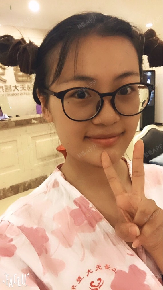 C苏丽珍自体脂肪填充脸颊第0天美丽日记-新氧