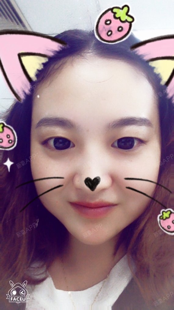 kate1990玻尿酸垫下巴第6天美丽日记-新氧美容