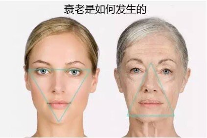 女性面部衰老示意图