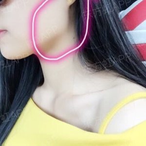 广州医科大学附属口腔医院下颌角整形怎么样?