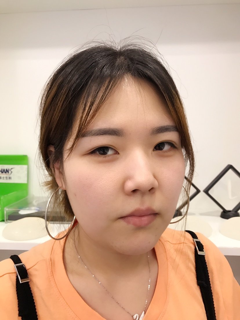如果丶我说的美丽日记"8.18"厚唇改薄