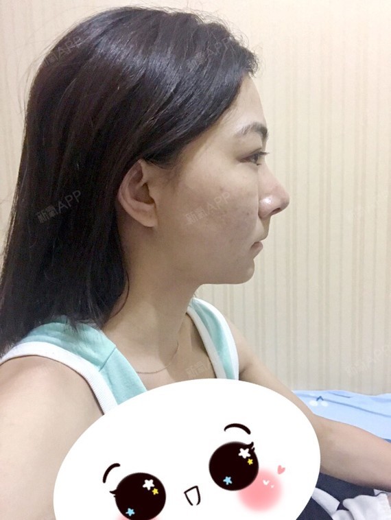 上嘴唇一点都不翘…喜欢翘起来的那种
