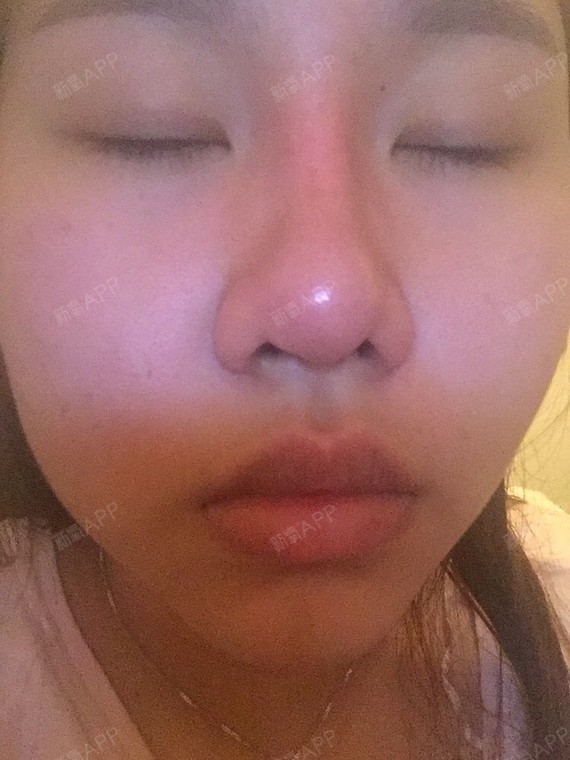 做坏了的鼻子就提告嘛?