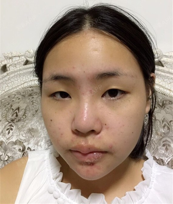 黄振银的医生说