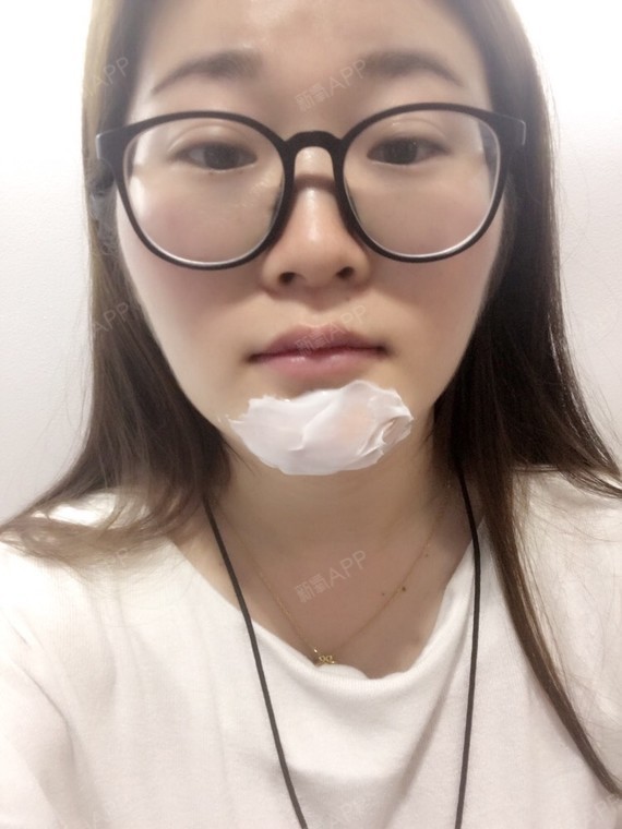 石柿子石狮子玻尿酸垫下巴第1天美丽日记-新氧