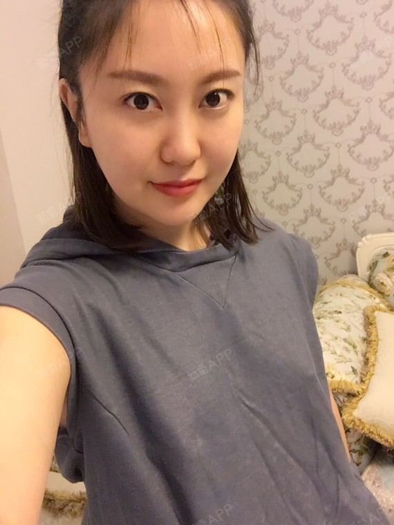 木子1126面部丽日第22天美吸脂记-新氧v面部整新款发尾烫发图片