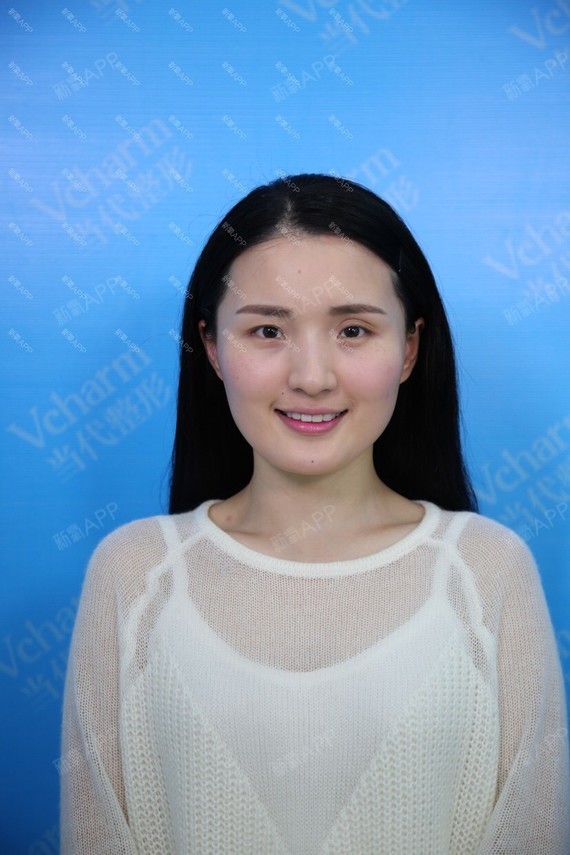 【重庆当代整形】阿尔法隐形双眼皮何为隐形阿