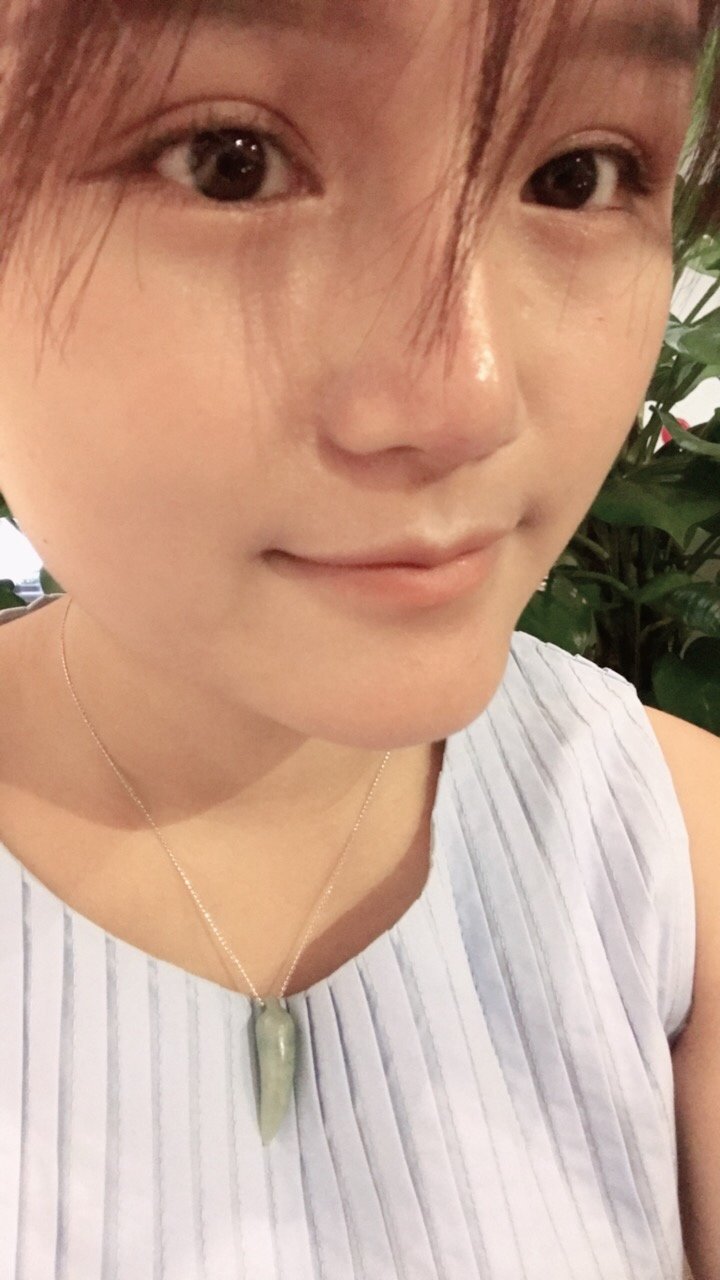 深圳兰乔医疗美容诊所开外眼角怎么样_恢复过程_效果