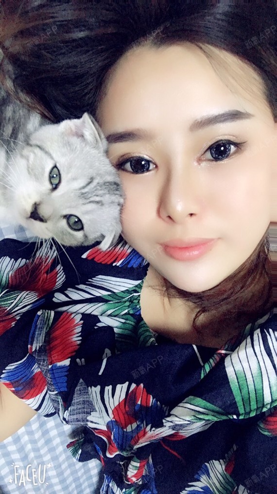 泰民爱水晶美丽日记-新氧美容整形