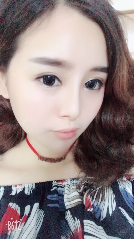 泰民爱水晶美丽日记-新氧美容整形