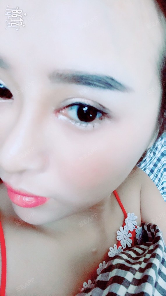 泰民爱水晶美丽日记-新氧美容整形