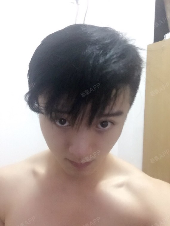 永远_550192种植发际线第337天美丽日记-新氧