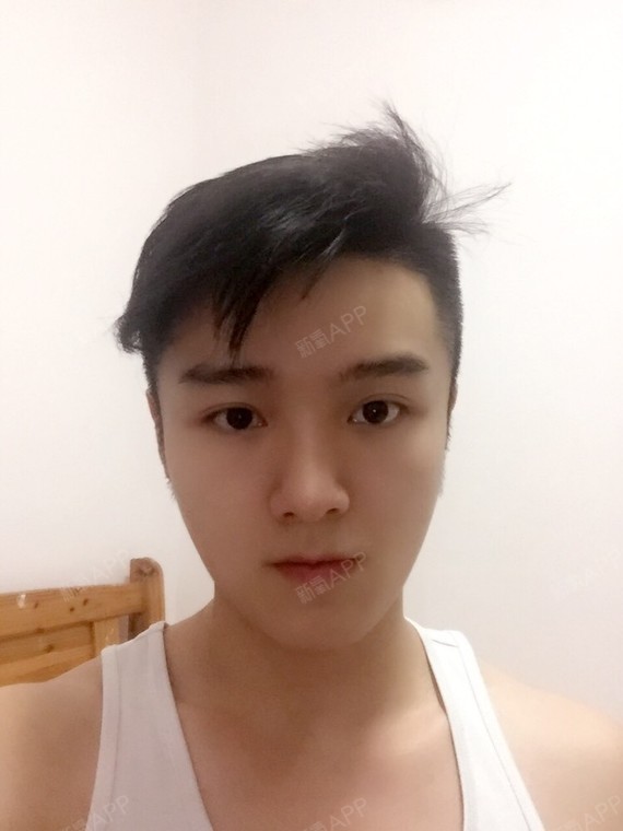 永远_550192种植发际线第337天美丽日记-新氧