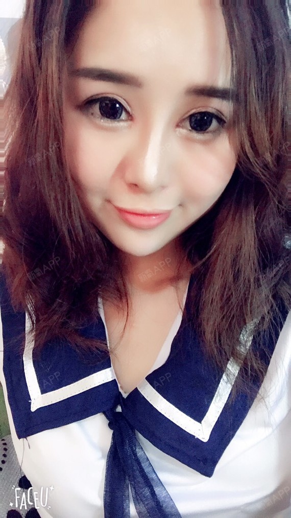 泰民爱水晶开内眼角第174天美丽日记-新氧美容