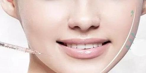 做完激光美容之后,可以做微整吗?只要不结痂、