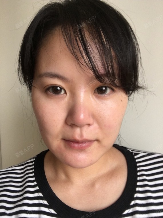 脸型偏长 显老 怎么才能让脸变小 ?面部五官精致而恰到好处?