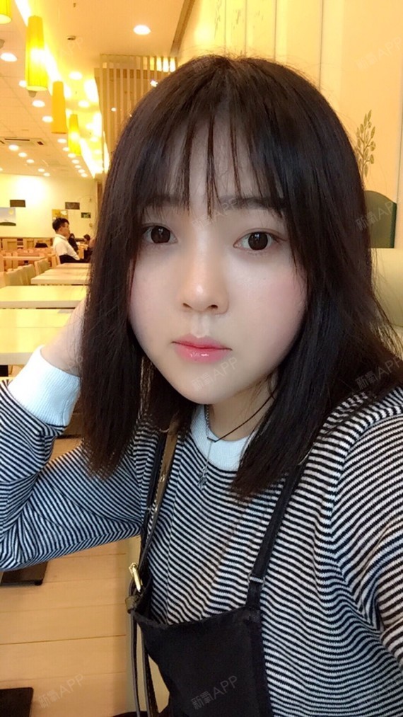 最真实的先变鬼玻尿酸垫下巴第0天美丽日记