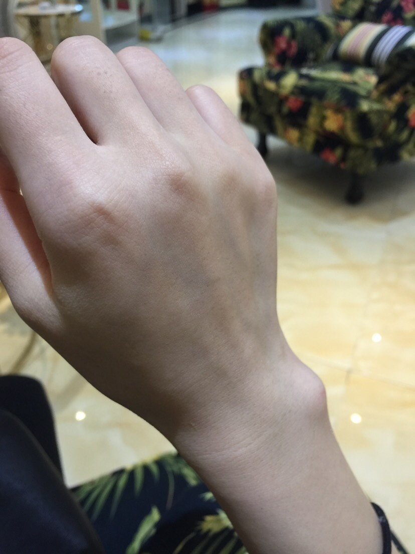 比基尼线脱毛第243天