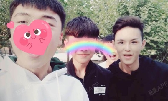 洪永香开内眼角第70天美丽日记-新氧美容整形